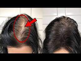 If you have dry hair, you can add some honey. How To Increase Volume And Density Of Hair Dr Vivek Joshi Youtube