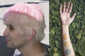 To understand sunburn, you need to know how UV provokes inflammation