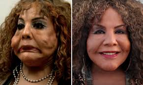 The editors of publications international, ltd. The Most Shocking Botched Plastic Surgery Transformations