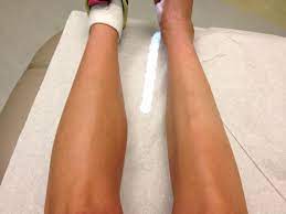 Diseases also cause muscle wasting. Causes And Prevention Of Muscle Atrophy After Stroke Saebo