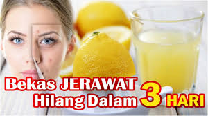 Jika terdapat kesalahan penulisan pada artikel atau link rusak. Cara Mudah Menghilangkan Jerawat Dalam 1 Hari Informasi Dunia Kesehatan