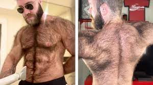 Hairy Man Says He's Compared To Real Life Werewolf - YouTube