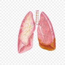 Learn about lung cancer early warning signs, symptoms and treatments. Non Small Cell Lung Cancer Bronchus Png 587x824px Watercolor Cartoon Flower Frame Heart Download Free
