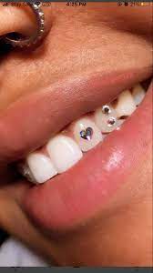 teeth gem teeth jewelry tooth gem diamond teeth