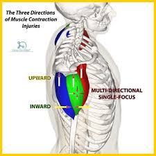 Deltoid Origin Insertion Action Nerve Supply How To Relief Deltoids Anatomy Reference Muscle Contraction