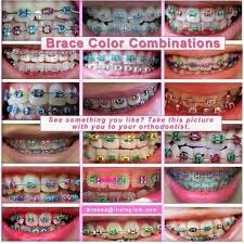 Check spelling or type a new query. Color Combinations Cute Braces Colors Braces Colors Combinations Cute Braces