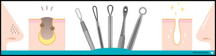 Many people who develop blackheads wish to remove them at home, but the deeper the. Blackhead Removal Tools Treatments The Ultimate Guide Skin Care Ox
