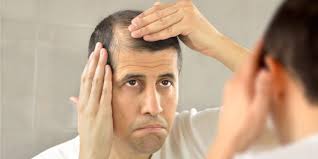 * the reason why the body does this is because dht is a steroid hormone, which means it has an anabolic effect which should help hair growth. What Is Dht Hair Loss Causes Treatments