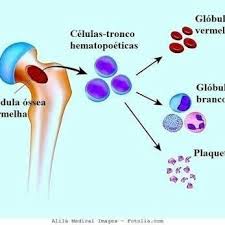 La leucemia mieloide cronica (lmc) è un disordine mieloproliferativo che ha un andamento tipicamente multifasico. Facebook