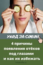 как быстро убрать отеки под глазами в домашних условиях Meshki Pod Glazami Chto Delat V 2020 G Glaza Meshki Pod Glazami Maski Dlya Lica