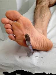 Apple crushing crush inshoe with high heels clogs barefoot. Injuries By Vertebrate Aquatic Animals Phylum Chordata Fish Reptiles And Mammals Springerlink