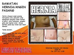 Jika belakunya gejala 'angin pasang' ini, penjagaannya menjadi bertambah rumit dan kebanyakannya. Urut Melayu Angin Pasang Home Facebook