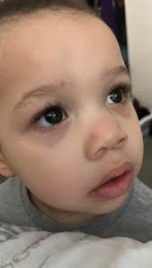 Hi. I am a single mom of a 8yr old boy. I see alot of signs of ADHD with my  son, but I overthink. I was curious if I could hear your