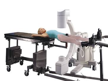 Advanced imaging systems are crucial for orthopedic precision, AI generated