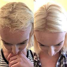 Deep conditioners can actually help you make your bleached hair healthy again. 3 Best Deep Conditioners For Bleached Hair