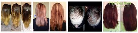 But there are small things you can do every day that may help. Hair Skin Nails Vitamins Before After