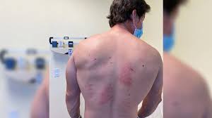We did not find results for: Mark Wahlberg Reveals Test Results I M Allergic To Everything Nz Herald