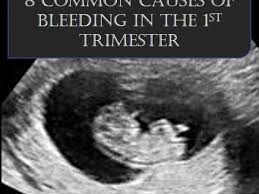 I phoned midwife on thurs, crying and she booked me a scan for monday. 8 Common Causes For Bleeding In The First Trimester Wehavekids