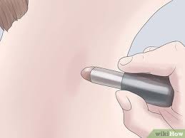 How do you get rid of a hickey fast. How To Get Rid Of A Hickey Fast 9 Steps With Pictures Wikihow