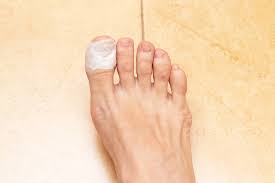We did not find results for: What Happens When You Lose A Toenail My Footdr