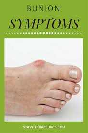 Pin On Bunion