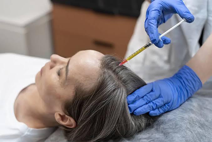 PRP For Hair Loss: How It Works And What To Expect - Dr. Helena Taylor  Clinic