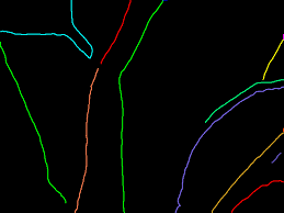 An unbiased detector of curvilinear structures. Vein Extraction From This Image Signal Processing Stack Exchange