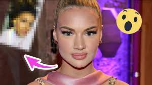 1,485 likes · 3 talking about this. Nase Verkleinert So Sieht Shirin David Nach Ihrer Beauty Op Aus Starzip