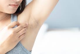 Dark underarms can be an embarrassing situation sometimes if you love to wear sleeveless.dark underarms are known as common beauty issue for millions of females and girls do such effects to hide their dark underarms or different kinds of products to get rid of them. How To Get Rid Of Dark Underarms Emedihealth