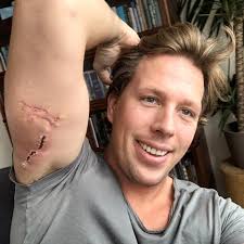 Hij heeft de aanval overleefd en er zijn ook geen vitale functies getroffen. Freek Vonk Na Beet Nog Doller Op Haaien Rtl Boulevard