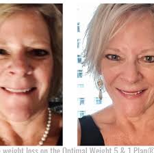 What is causing spots