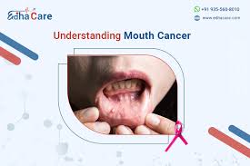 Image result for gum cancer symptoms