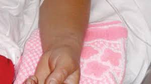 Este posibil ca la spital sa mai ajunga si alti copii de la unitatea respectiva. Quot CornuleÅ£ Cu Lapte Quot Expirate 12 Copii Au Ajuns La Spital Cu ToxiinfecÅ£ie AlimentarÄƒ