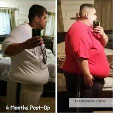 Pin On Weight Loss Surgery Testimonials