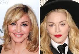 Madonna Plastic Surgery: How The Madge's Face Has Changed