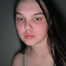 How to get help with dog medical bills in North Texas?