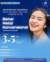 Tahun baru sebentar lagi! 🥳 Jangan biarkan gigi yang berantakan jadi  penghalang senyum sempurna kamu di tahun 2026! ✨ Akhir tahun adalah momen  tepat mulai behel karena: