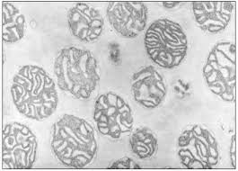 The primary aim of treatment is to alleviate symptoms and slow the progression of the condition. The Molecular Biology Of Plant Cells