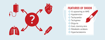 Image result for Shock