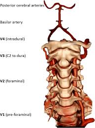 The aorta branches into a network of smaller arteries that extend throughout the body. Vertebral Artery Anatomy Used With Permission From Frank Gaillard Download Scientific Diagram