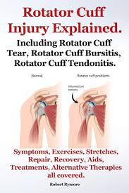 Tears in the rotator cuff are very very common. Rotator Cuff Injury Explained Including Rotator Cuff Tear Rotator Cuff Bursitis Rotator Cuff Tendonitis Symptoms Exercises Stretches Repair Re Rymore Robert 9781909151710 Amazon Com Books