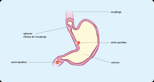La guérison peut être obtenue si la prise en charge est précoce. Symptomes Et Diagnostic De L Ulcere Gastroduodenal Ameli Fr Assure