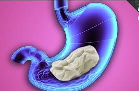 What To Do After Swallowing Chewing Gum Swallowing Chewing Gum Chewing Gum Gum Health