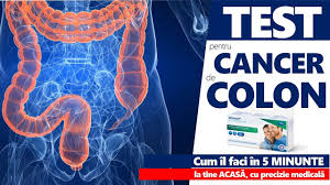 Polipii colului uterin se dezvoltă în regiunea istmului uterin în porţiunea superioară sau medie a endocervixului. Cancer De Colon Cancer Colorectal Cum Se Face Testul Hemocult Care Il DepisteazÄƒ Youtube