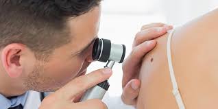 14.08.2019 · unusual moles, sores, lumps, blemishes, markings, or changes in the way an area of the skin looks or feels may be a sign of melanoma or another type of skin … Skin Cancer Or Harmless Mole Can You Tell The Difference