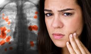 Lung cancer—a disease in which abnormal cells clump together to form a tumor that begins in the lungs—is the most common cancer worldwide and. Lung Cancer Does Your Face Look Like The Unusual Signs To Watch Out For Revealed Sound Health And Lasting Wealth