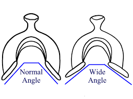 Western Saddle Fitting And Different Tree Sizes Quarter