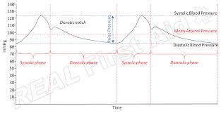 Image result for Pulse Pressure