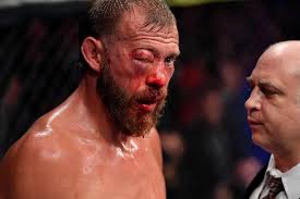 Watch videos from the ufc 238 collection on watch espn. Ufc 238 Medical Suspensions Donald Cerrone Out Indefinitely