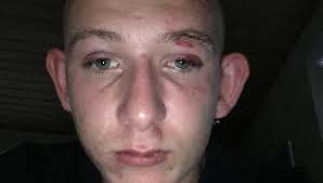 Patrick slået ned af unge med indvandrerbaggrund: 'Det er så kujonagtigt'